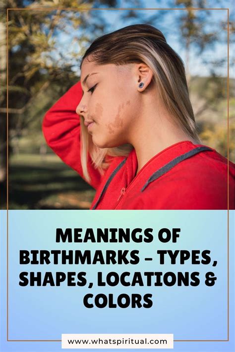 birthmark on penis|The Meaning of Birthmarks: Locations, Colors